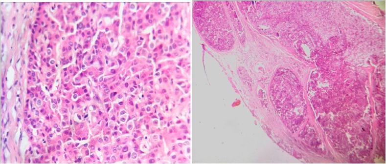 https://cdn.ncbi.nlm.nih.gov/pmc/blobs/3ea6/8517712/60d494b9ce48/gr3.jpg