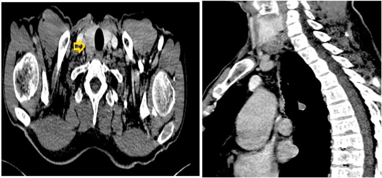 https://cdn.ncbi.nlm.nih.gov/pmc/blobs/3ea6/8517712/89a7e4d46655/gr1.jpg