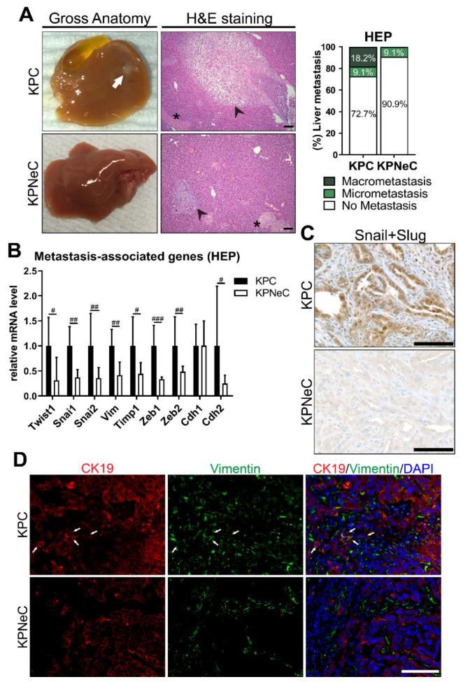 https://cdn.ncbi.nlm.nih.gov/pmc/blobs/3ea9/8471477/d01cca61f655/cancers-13-04541-g003.jpg