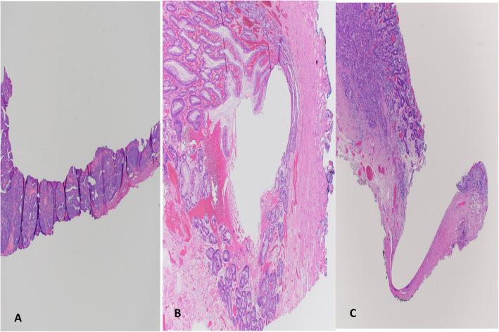 https://cdn.ncbi.nlm.nih.gov/pmc/blobs/3eac/8627628/228de4d498fa/13000_2021_1169_Fig5_HTML.jpg