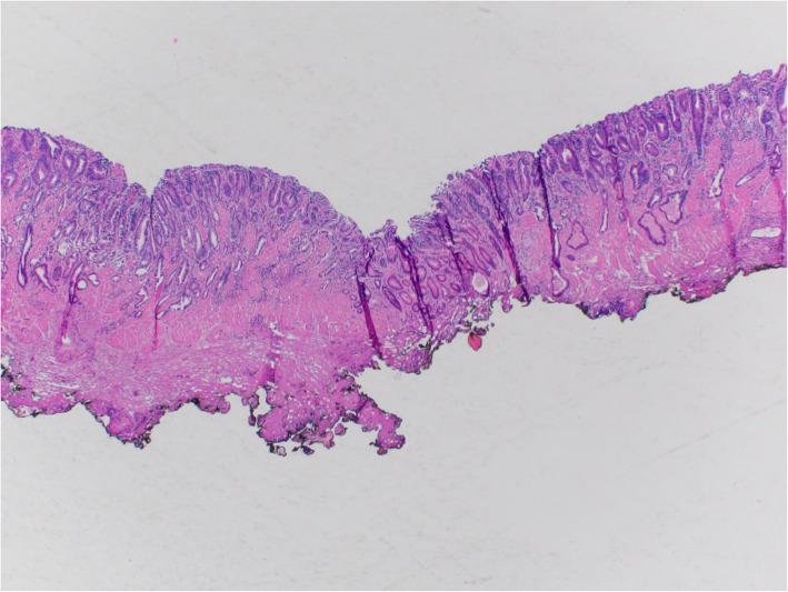 https://cdn.ncbi.nlm.nih.gov/pmc/blobs/3eac/8627628/57cddbec1d43/13000_2021_1169_Fig6_HTML.jpg