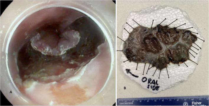 https://cdn.ncbi.nlm.nih.gov/pmc/blobs/3eac/8627628/663ad7c9ea93/13000_2021_1169_Fig1_HTML.jpg