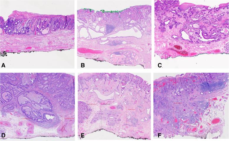 https://cdn.ncbi.nlm.nih.gov/pmc/blobs/3eac/8627628/7f085dbf4ed8/13000_2021_1169_Fig3_HTML.jpg