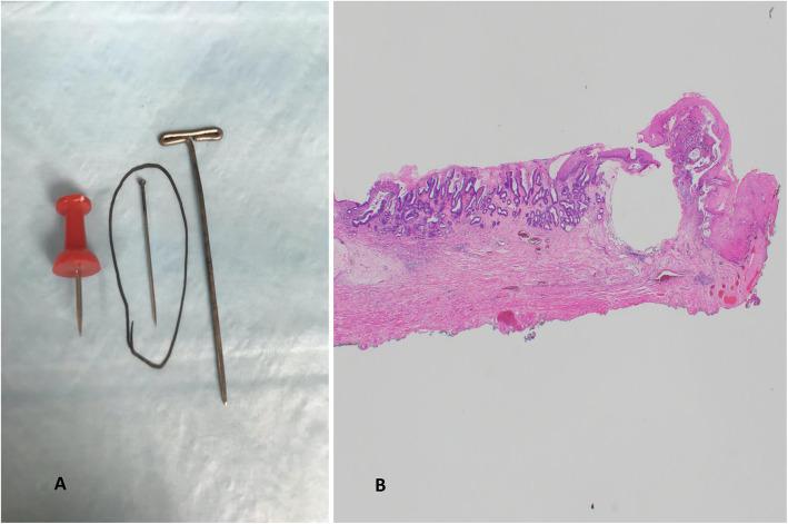 https://cdn.ncbi.nlm.nih.gov/pmc/blobs/3eac/8627628/93468e8b6477/13000_2021_1169_Fig7_HTML.jpg