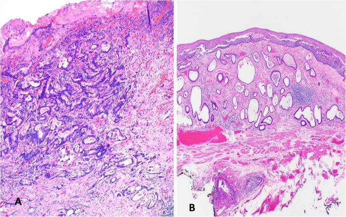 https://cdn.ncbi.nlm.nih.gov/pmc/blobs/3eac/8627628/dacd6c318165/13000_2021_1169_Fig2_HTML.jpg