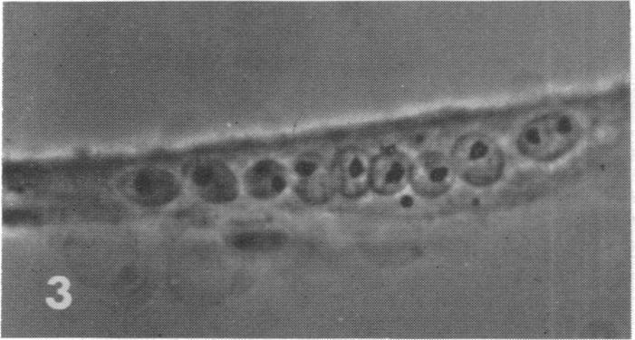 https://cdn.ncbi.nlm.nih.gov/pmc/blobs/3eb2/224404/233123834ba9/pnas00147-0221-d.jpg