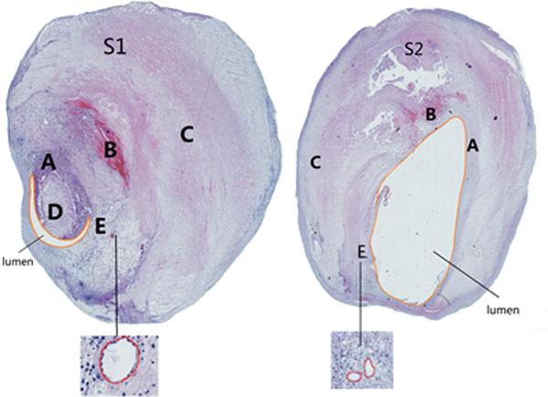 https://cdn.ncbi.nlm.nih.gov/pmc/blobs/3eb4/4306113/22193a0ca85d/1475-925X-14-S1-S3-1.jpg