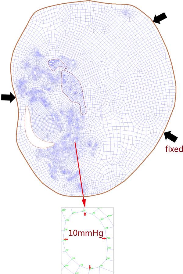 https://cdn.ncbi.nlm.nih.gov/pmc/blobs/3eb4/4306113/436d21e729c3/1475-925X-14-S1-S3-2.jpg