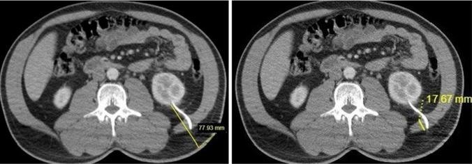 https://cdn.ncbi.nlm.nih.gov/pmc/blobs/3eb7/12052929/51033aef783d/270_2025_4020_Fig5_HTML.jpg