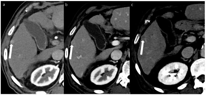 https://cdn.ncbi.nlm.nih.gov/pmc/blobs/3ec5/11507254/38f026d92d26/diagnostics-14-02308-g002.jpg