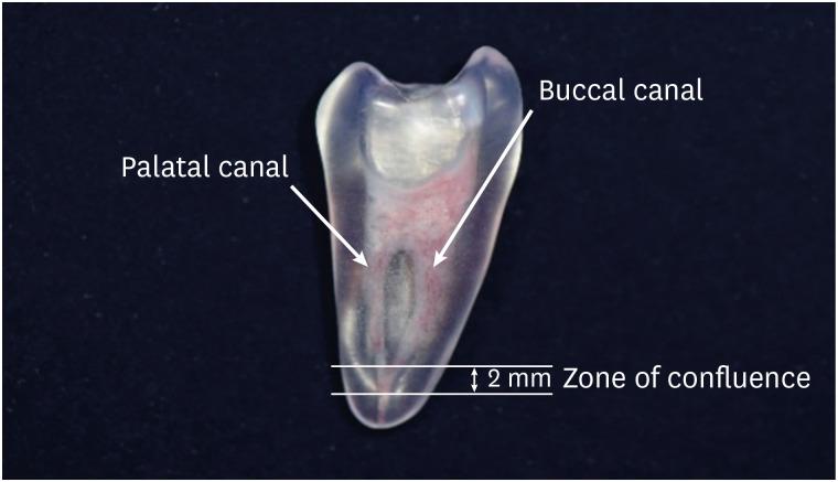 https://cdn.ncbi.nlm.nih.gov/pmc/blobs/3ec5/7906847/6d4f1935e18f/rde-46-e12-g001.jpg