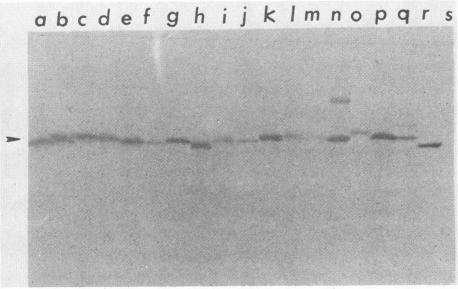 https://cdn.ncbi.nlm.nih.gov/pmc/blobs/3ecf/313586/f24cc4423286/iai00057-0202-a.jpg