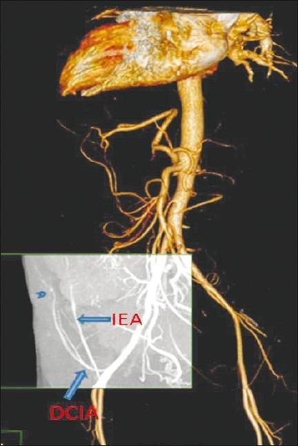 https://cdn.ncbi.nlm.nih.gov/pmc/blobs/3ed0/3328980/a3fd2a27016f/JCIS-2-10-g006.jpg