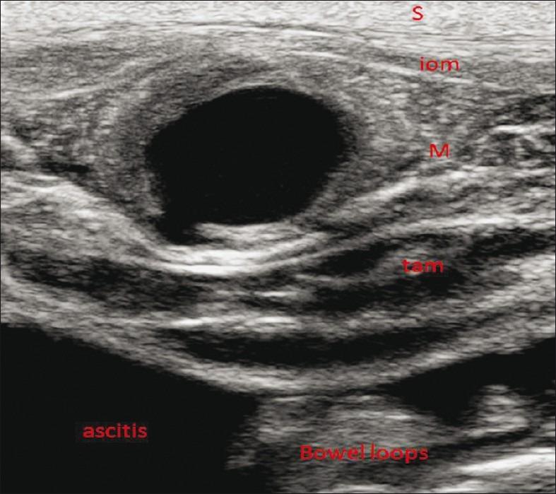 https://cdn.ncbi.nlm.nih.gov/pmc/blobs/3ed0/3328980/f38362d46527/JCIS-2-10-g002.jpg