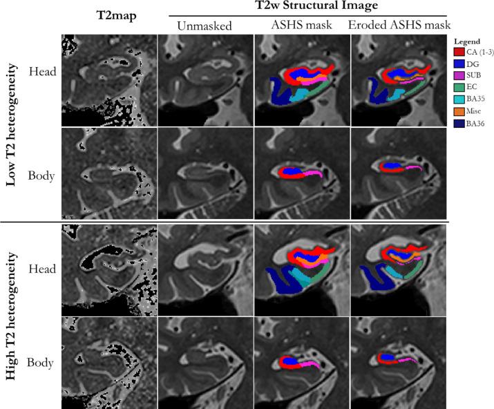 https://cdn.ncbi.nlm.nih.gov/pmc/blobs/3ed9/8350145/ea5be91c3d36/gr1.jpg