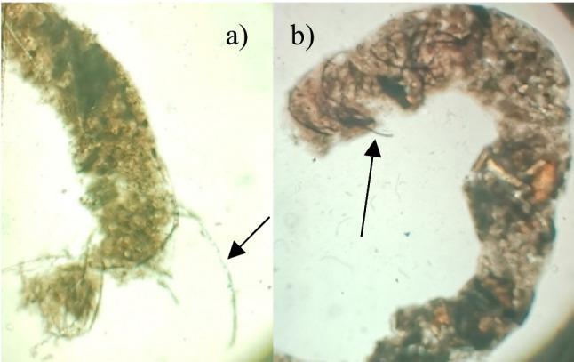 https://cdn.ncbi.nlm.nih.gov/pmc/blobs/3edf/11364605/60ae51f92622/11356_2024_34626_Fig1_HTML.jpg