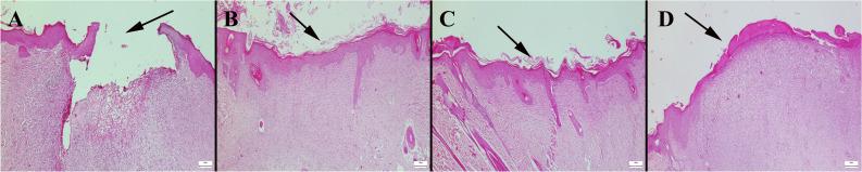 https://cdn.ncbi.nlm.nih.gov/pmc/blobs/3ee6/11872767/025381fe0bb7/12011_2024_4268_Fig11_HTML.jpg