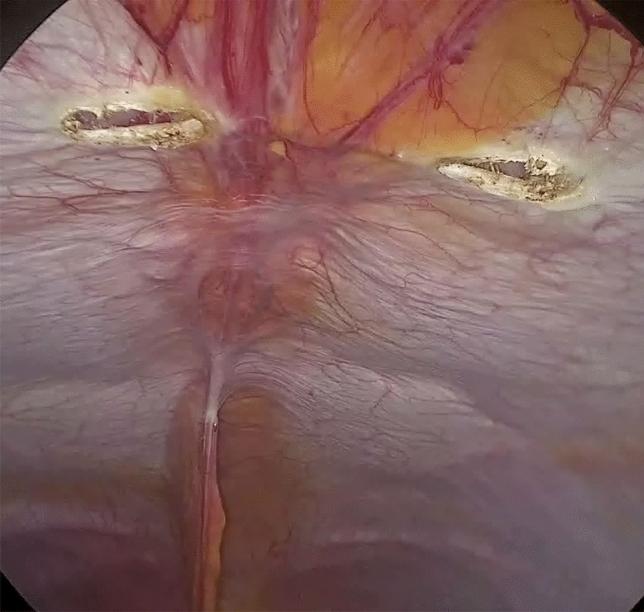 https://cdn.ncbi.nlm.nih.gov/pmc/blobs/3eea/8195785/9fe5210dee0c/464_2021_8393_Fig4_HTML.jpg