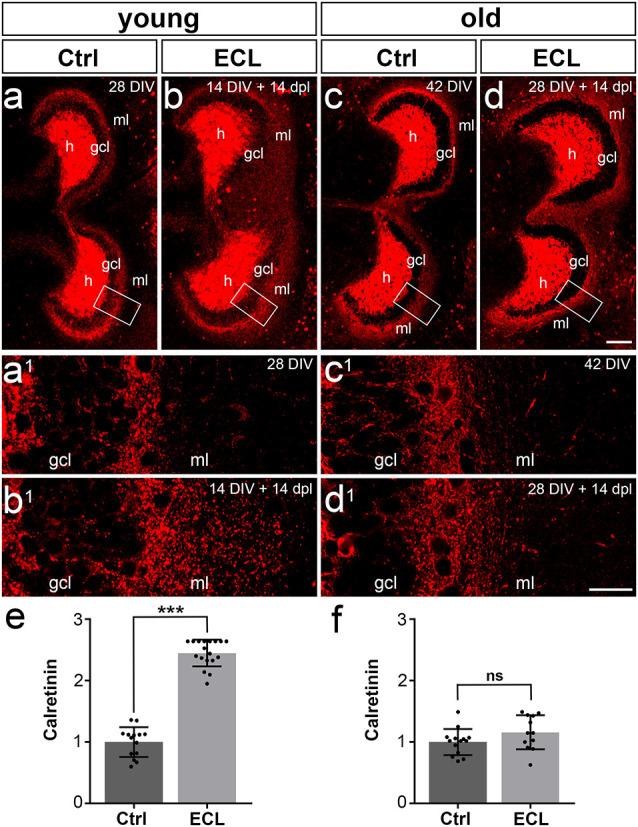 https://cdn.ncbi.nlm.nih.gov/pmc/blobs/3ef2/8194403/21d11f49fe8c/fnana-15-682383-g0002.jpg