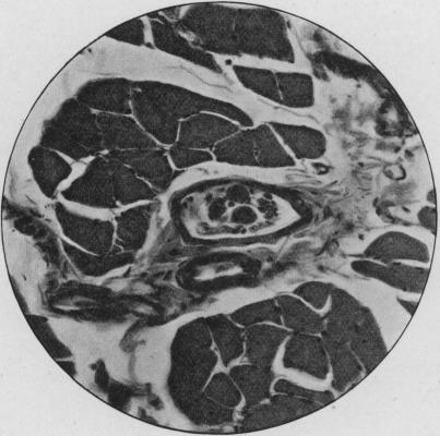 https://cdn.ncbi.nlm.nih.gov/pmc/blobs/3ef6/2045888/62b7abac61fd/procrsmed00853-0091-a.jpg