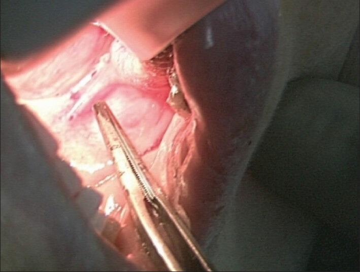 https://cdn.ncbi.nlm.nih.gov/pmc/blobs/3eff/4173590/d18b075875c8/AER-8-111-g002.jpg