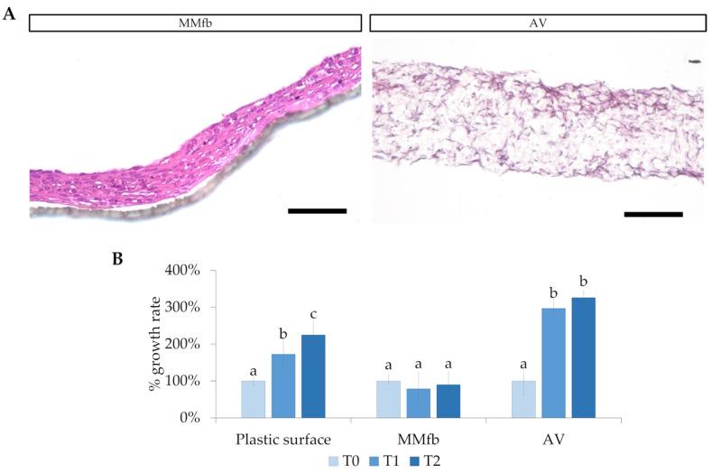 https://cdn.ncbi.nlm.nih.gov/pmc/blobs/3f00/10377977/3fddf397fd06/cells-12-01843-g002.jpg