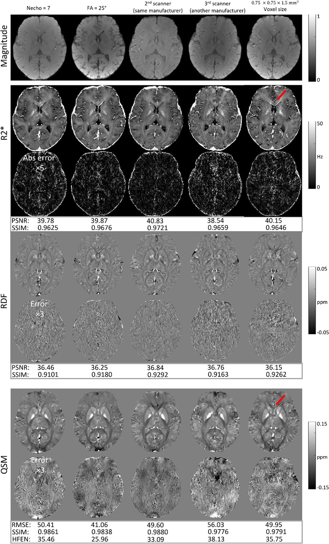 https://cdn.ncbi.nlm.nih.gov/pmc/blobs/3f04/10021353/9c0cb96137c2/nihms-1874422-f0009.jpg