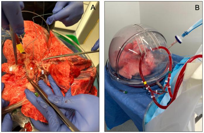 https://cdn.ncbi.nlm.nih.gov/pmc/blobs/3f0a/11432129/906b6d28e0a1/jcm-13-05516-g003.jpg