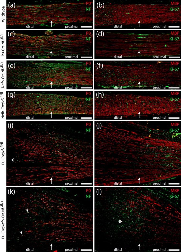 https://cdn.ncbi.nlm.nih.gov/pmc/blobs/3f0a/4947119/1c5fdbb89e39/401_2016_1583_Fig4_HTML.jpg
