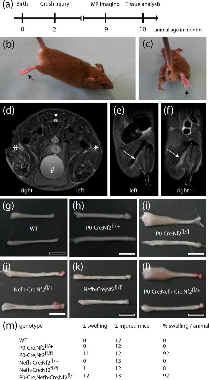 https://cdn.ncbi.nlm.nih.gov/pmc/blobs/3f0a/4947119/43c4d8ad40f7/401_2016_1583_Fig1_HTML.jpg