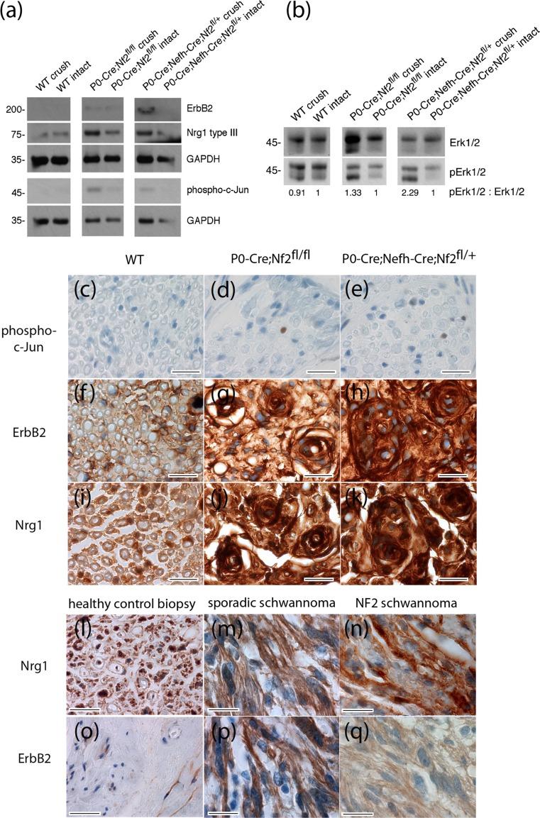 https://cdn.ncbi.nlm.nih.gov/pmc/blobs/3f0a/4947119/63ee184a7f34/401_2016_1583_Fig5_HTML.jpg