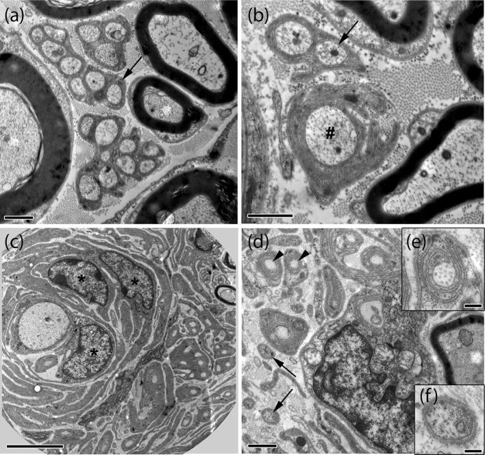 https://cdn.ncbi.nlm.nih.gov/pmc/blobs/3f0a/4947119/a7aa4c6aa23a/401_2016_1583_Fig3_HTML.jpg