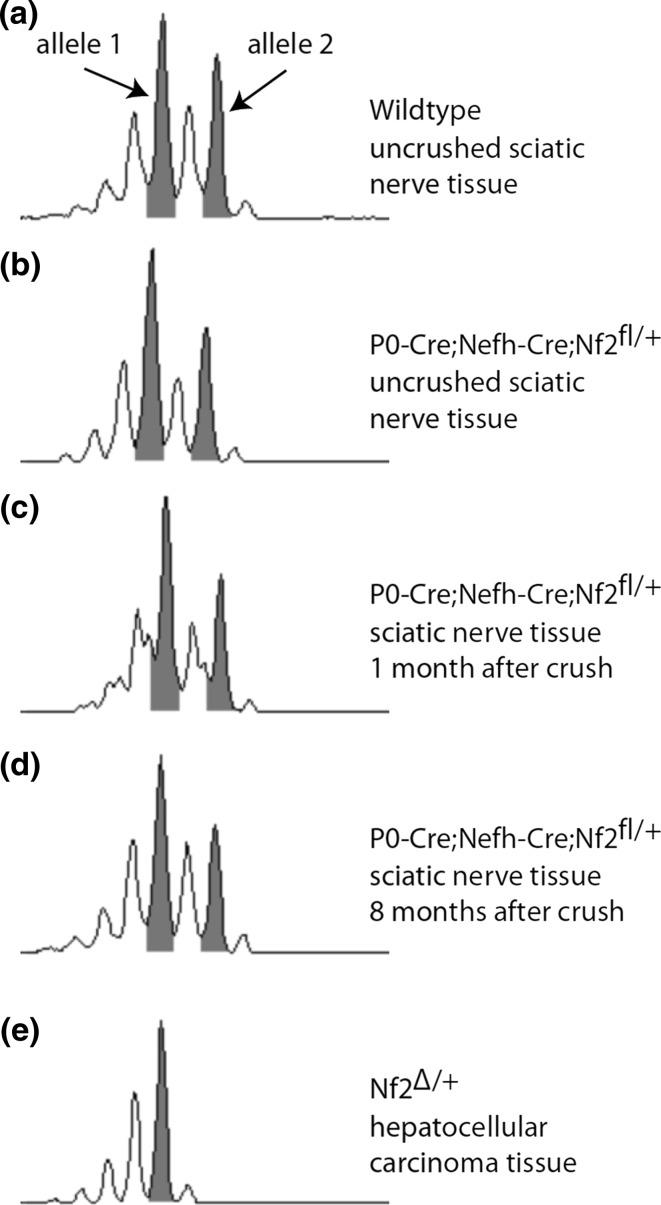 https://cdn.ncbi.nlm.nih.gov/pmc/blobs/3f0a/4947119/ac951d8d748e/401_2016_1583_Fig6_HTML.jpg