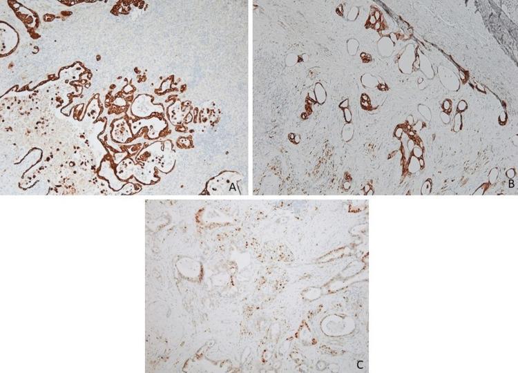 https://cdn.ncbi.nlm.nih.gov/pmc/blobs/3f0e/10056760/1f1bb71104e4/cureus-0015-00000035541-i04.jpg