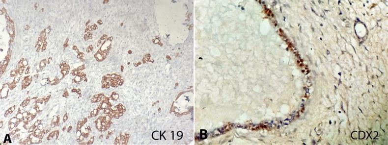 https://cdn.ncbi.nlm.nih.gov/pmc/blobs/3f10/8214896/e659567f2ea8/autopsy-11-e2021248-gf04.jpg