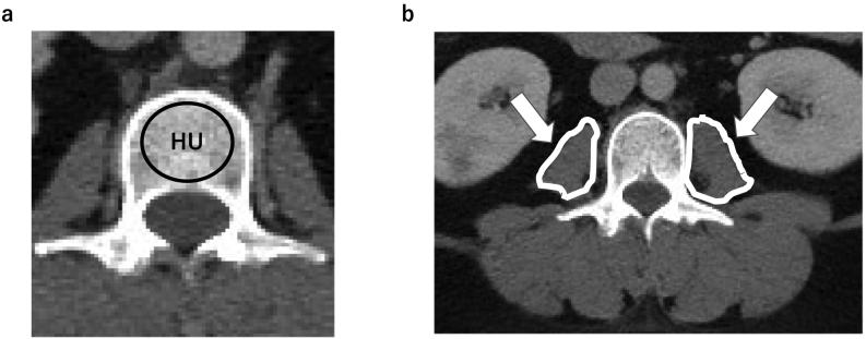 https://cdn.ncbi.nlm.nih.gov/pmc/blobs/3f10/9946851/62c8cfe7ff8e/gr1.jpg