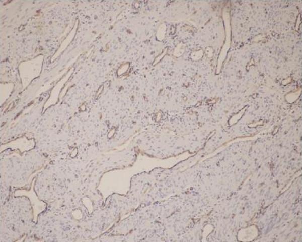 https://cdn.ncbi.nlm.nih.gov/pmc/blobs/3f12/2880140/550655ebd98f/1752-1947-4-136-2.jpg