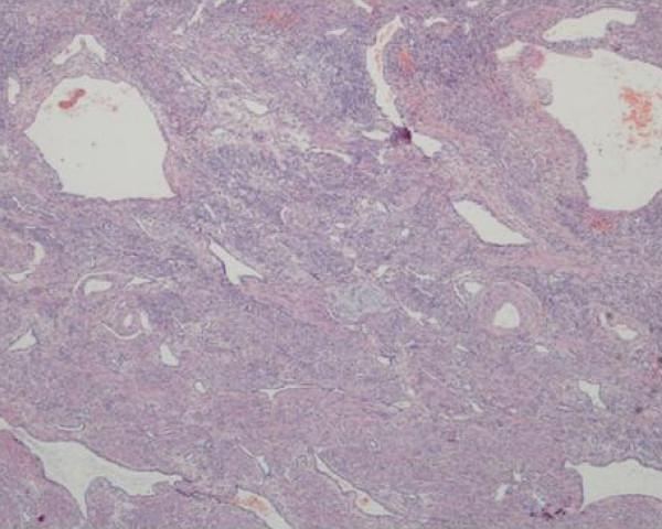 https://cdn.ncbi.nlm.nih.gov/pmc/blobs/3f12/2880140/fa170652ba64/1752-1947-4-136-1.jpg
