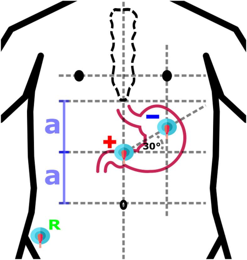 https://cdn.ncbi.nlm.nih.gov/pmc/blobs/3f14/11248517/c506b79bd924/fmed-11-1369753-g0004.jpg