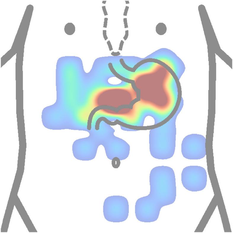 https://cdn.ncbi.nlm.nih.gov/pmc/blobs/3f14/11248517/f73a1ae8bf0d/fmed-11-1369753-g0010.jpg