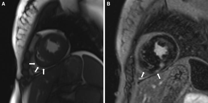 https://cdn.ncbi.nlm.nih.gov/pmc/blobs/3f15/7713380/943856296f72/41598_2020_78245_Fig3_HTML.jpg