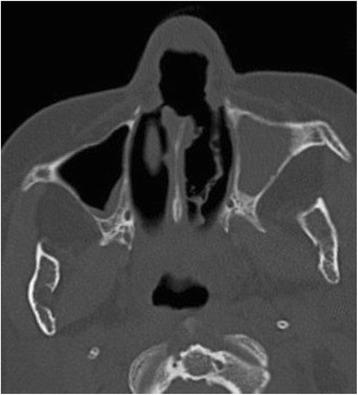 https://cdn.ncbi.nlm.nih.gov/pmc/blobs/3f18/5501116/7f5b676008eb/12879_2017_2571_Fig2_HTML.jpg