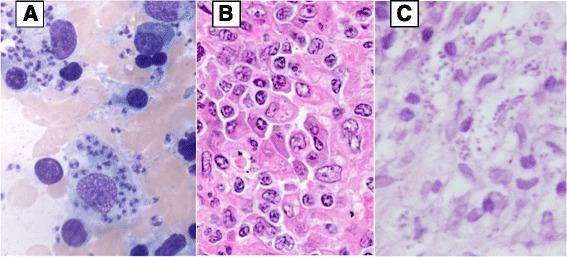 https://cdn.ncbi.nlm.nih.gov/pmc/blobs/3f18/5501116/9ebf2ed98a1f/12879_2017_2571_Fig1_HTML.jpg