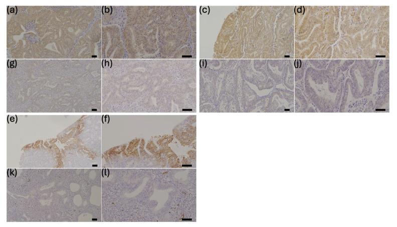 https://cdn.ncbi.nlm.nih.gov/pmc/blobs/3f25/12345884/e9fafbf832dc/cancers-17-02554-g001.jpg
