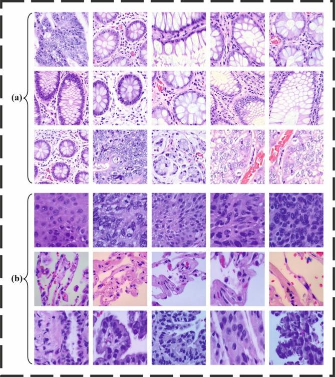 https://cdn.ncbi.nlm.nih.gov/pmc/blobs/3f2b/12234976/b572f25150fd/41598_2025_10246_Fig6_HTML.jpg
