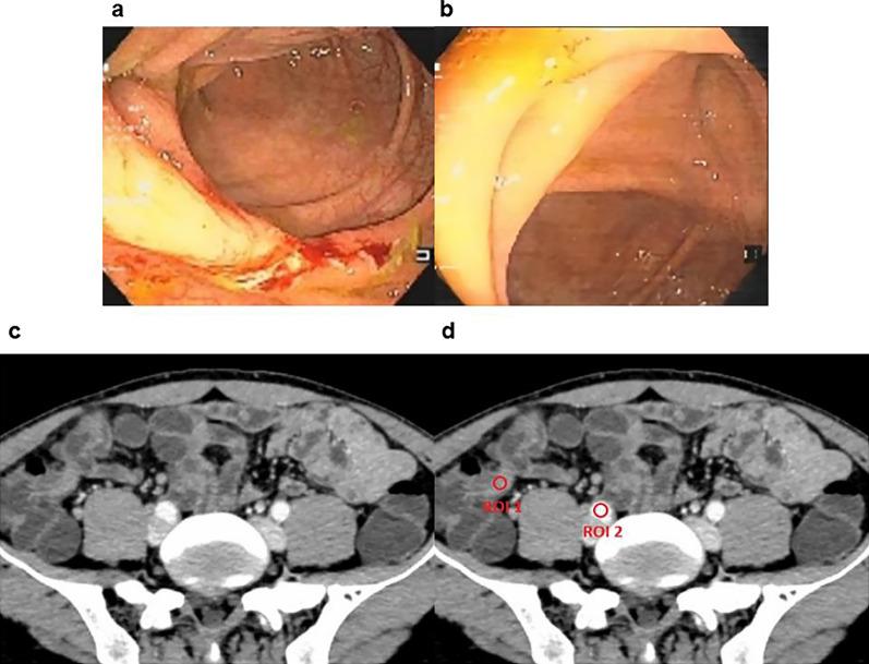 https://cdn.ncbi.nlm.nih.gov/pmc/blobs/3f2c/10102270/2430019de536/13244_2023_1397_Fig3_HTML.jpg