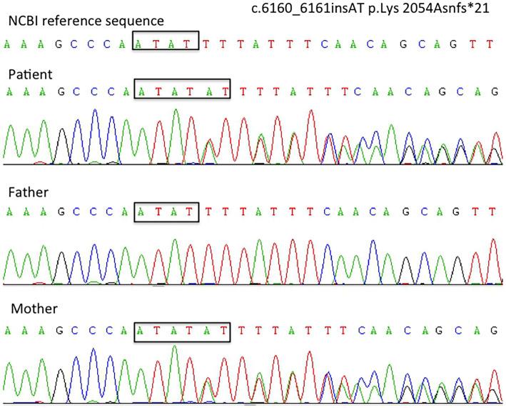 https://cdn.ncbi.nlm.nih.gov/pmc/blobs/3f2d/8710367/caf7b0849850/1349-7235-60-3721-g001.jpg