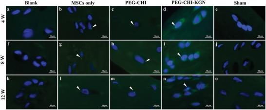https://cdn.ncbi.nlm.nih.gov/pmc/blobs/3f34/9762312/b121b1329d40/ADVS-9-2105571-g004.jpg