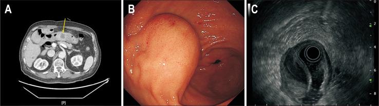 https://cdn.ncbi.nlm.nih.gov/pmc/blobs/3f36/10651380/c5ecd8985027/gnl-17-6-949-f1.jpg