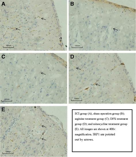 https://cdn.ncbi.nlm.nih.gov/pmc/blobs/3f39/5437601/9c9eacf9b37e/13018_2017_578_Fig7_HTML.jpg